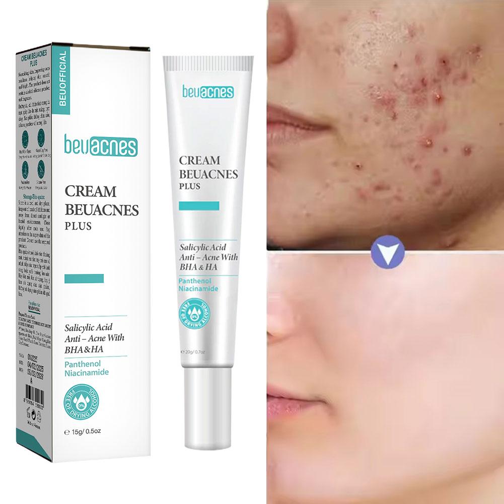 New 20g Niacinamide Acne Gel A – Skincare Niacinamide recenzja i cena