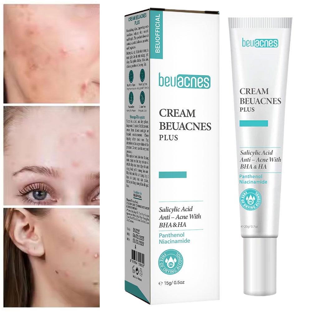New 20g Niacinamide Acne Gel A – Skincare Niacinamide recenzja i cena