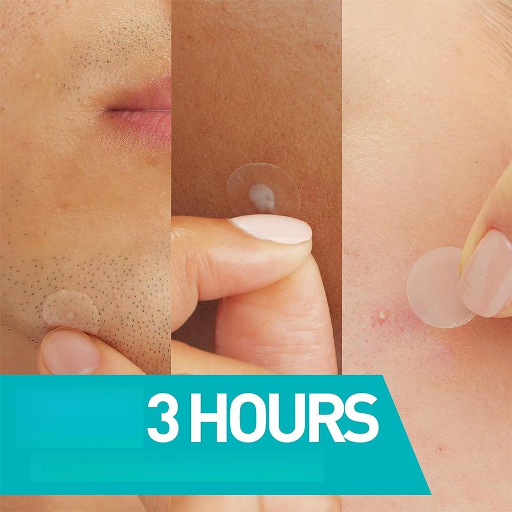 Invisible Pimple Patch 24/200/ – Skincare Acne recenzja i cena