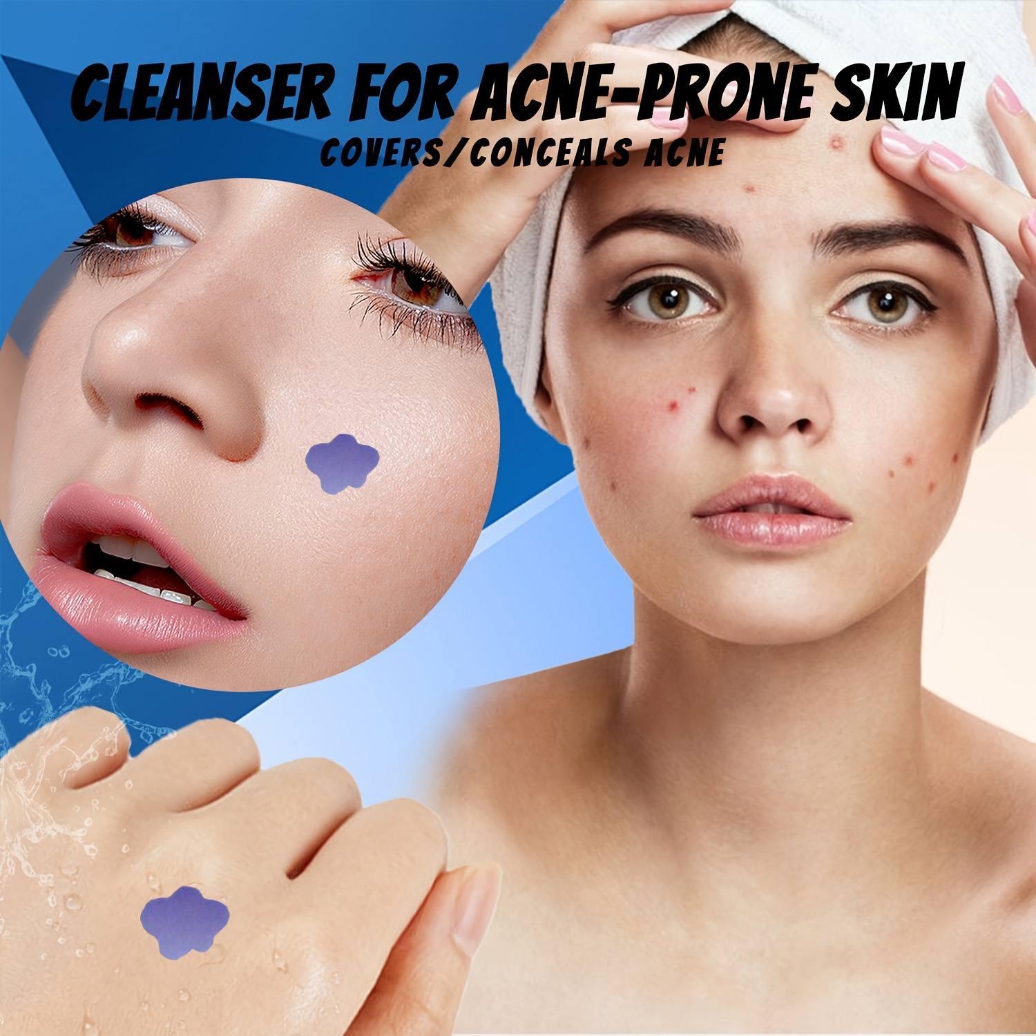 Microneedle Acne Pimple Patch  – Skincare Acne recenzja i cena