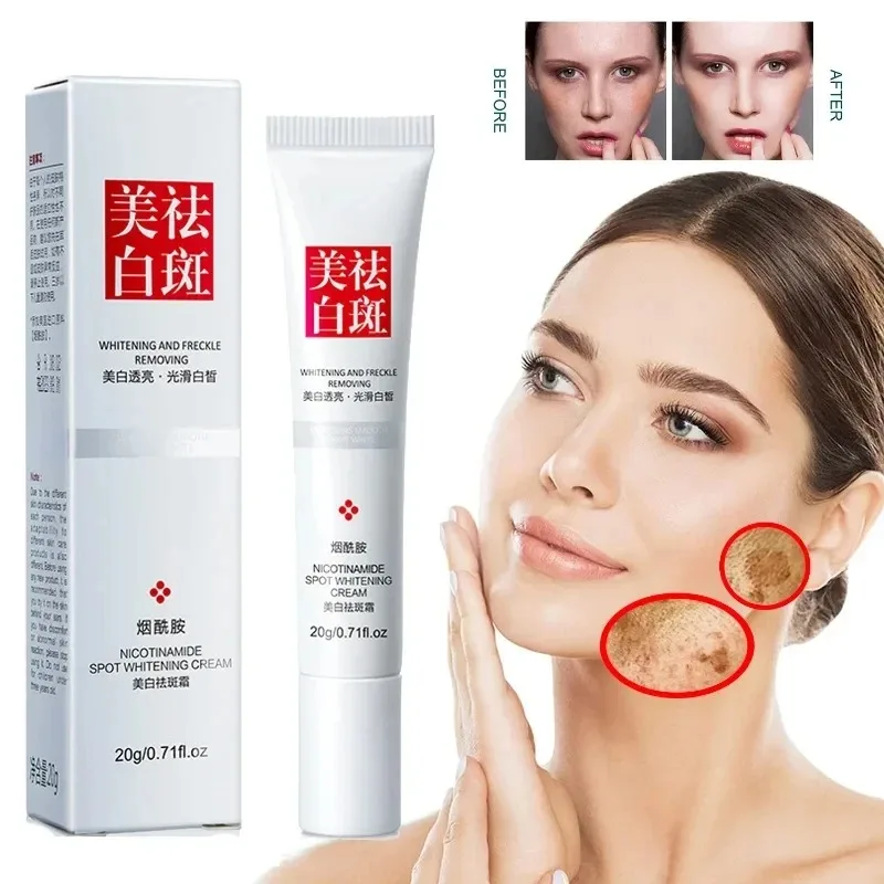 Fades Freckle Dark Spots Face  – Skincare Niacinamide recenzja i cena