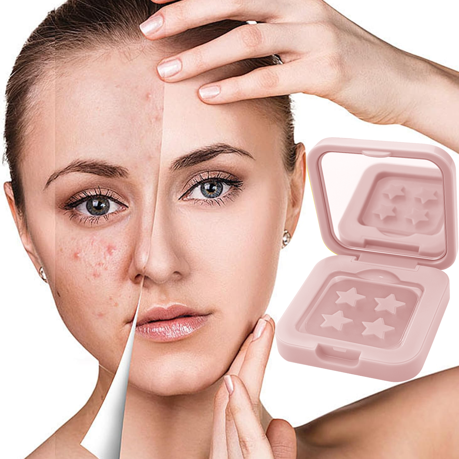 60 Acne Patch, Alcohol and Fra – Skincare Acne recenzja i cena