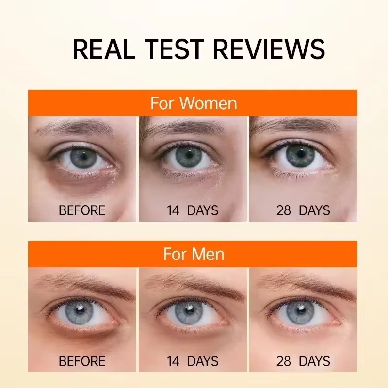 Anti Dark Circle Eye Serum Oil – Hyaluronic Acid Serum recenzja i cena